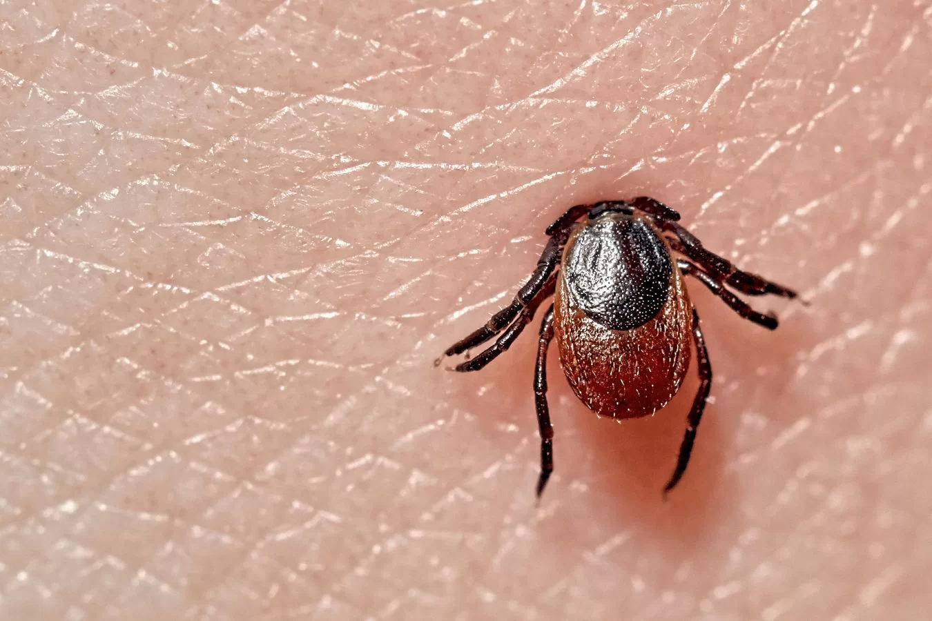 Peste 50 de cazuri de boala Lyme, înregistrate în R. Moldova. Câte cazuri sunt în Ialoveni 1 boala lyme